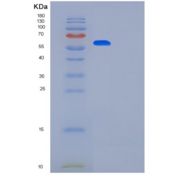 人亲核素α2(KPNa2)重组蛋白