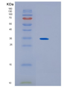 人KCTD4重组蛋白