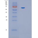 人白介素12受体β1(IL12Rb1)重组蛋白
