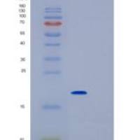 大鼠IL1rn重组蛋白