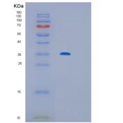 人IL12P40重组蛋白