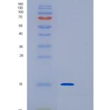 人干扰素调节因子1(IRF1)重组蛋白