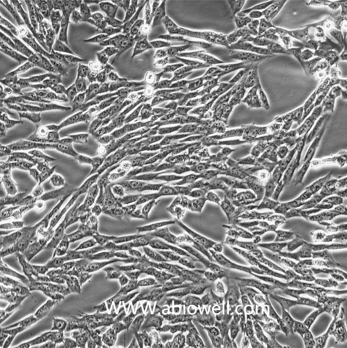 小鼠骨髓间充质干细胞永生化