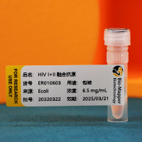 艾滋病抗体/HIV P24 抗体