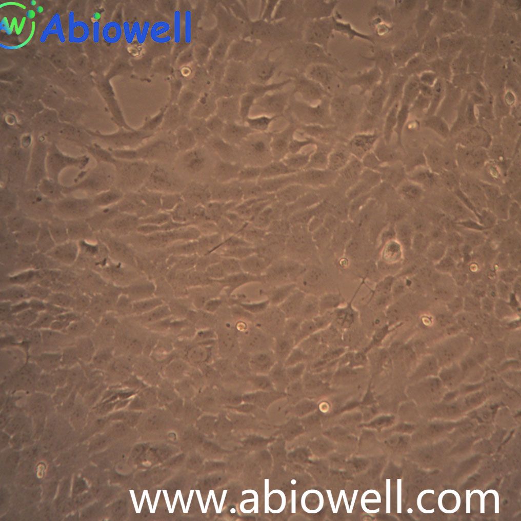 RF/6A  猴脉络膜-视网膜内皮细胞