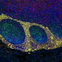 Oct-2 (ABT211) Mouse mAb (Ready to Use)