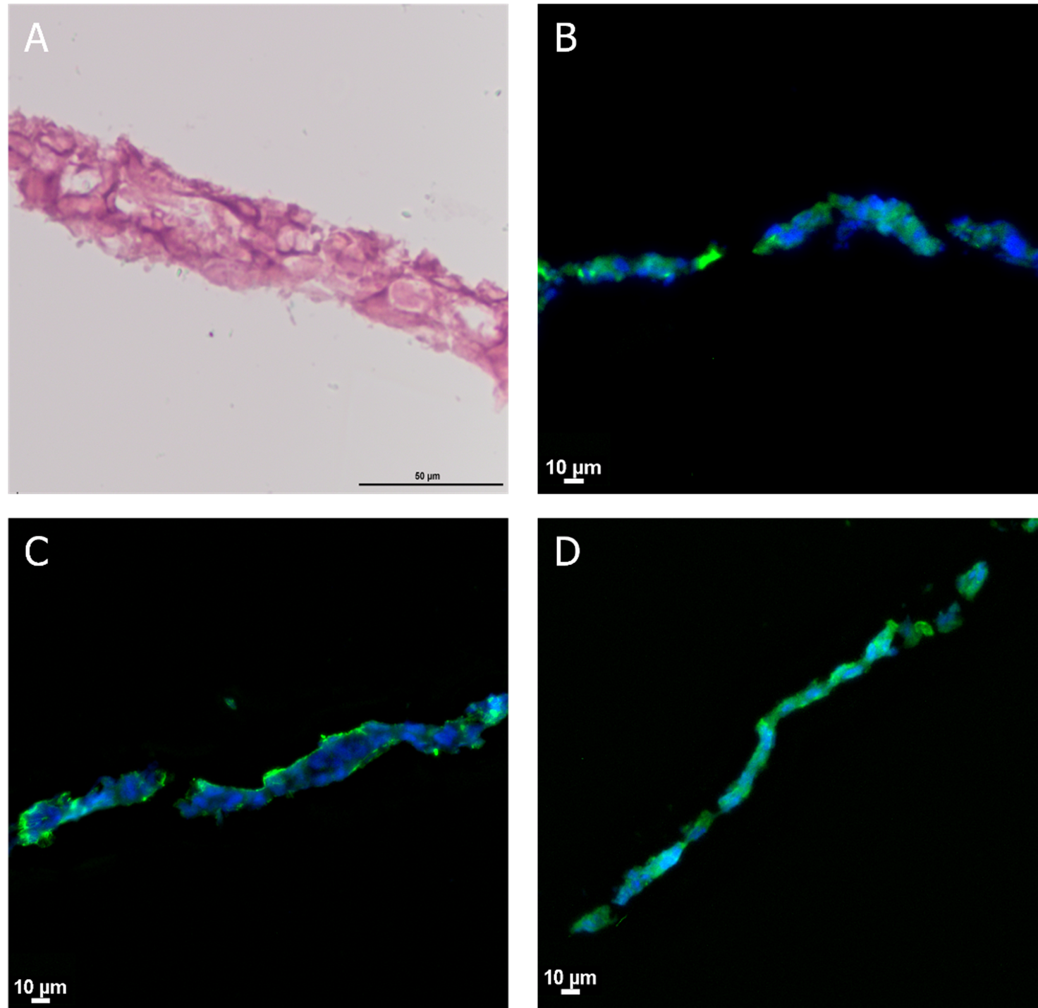 点成案例 | BE-Transflow芯片构建上皮模型用于渗透性研究