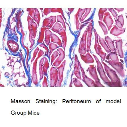 腹膜纤维化(PF)小鼠模型