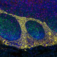 GFAP (ABT470) Mouse mAb