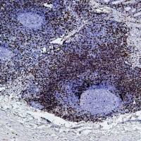 Polymer HRP Goat Anti Mouse/Rabbit IgG(H+L)-P