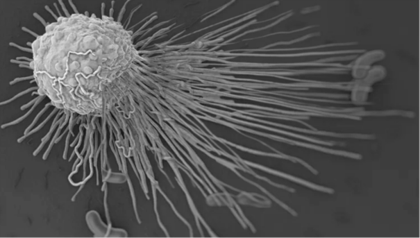 IPHASE/汇智和源 吞噬能力最强的免疫细胞——巨噬细胞