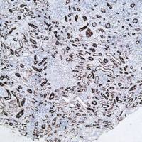 Polymer HRP (Mouse/Rabbit) IHC Kit (DAB)-P