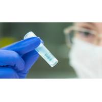 ZeptoMetrix PROtrol™ B 型呼吸道合胞病毒 (RSV-B)抗原质控品 (株系