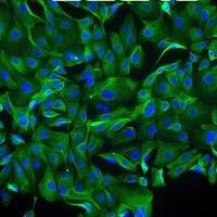 人卵巢表层上皮细胞