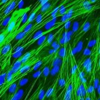 人支气管平滑肌细胞