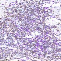 组化双染试剂盒