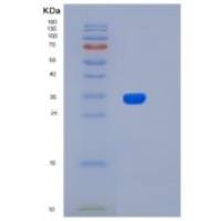 人Livin beta重组蛋白