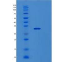 大肠杆菌map重组蛋白