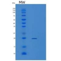 人Lin28重组蛋白