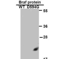 BRAF (D594G)