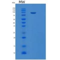 人白血病抑制因子受体(LIFR)重组蛋白