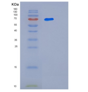 人白三烯A4水解酶(LTA4H)重组蛋白