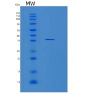 人基膜聚糖(LUM)重组蛋白