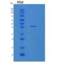 人基膜聚糖(LUM)重组蛋白
