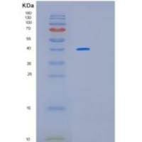 人低密度脂蛋白受体相关蛋白关联蛋白1(LRPAP1)重组蛋白