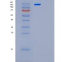 人LRS（亮氨酰tRNA合成酶）重组蛋白