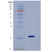 小鼠半乳糖凝集素9(GAL9)重组蛋白