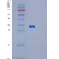 人黑色素瘤抗原家族D1(MAGED1)重组蛋白