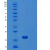 人微管关联蛋白1轻链3β(MAP1LC3b)重组蛋白