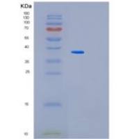 人MAK16重组蛋白