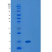 人LAMTOR2重组蛋白