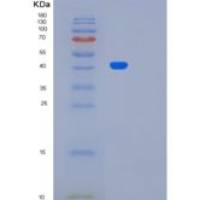 人LRP2BP重组蛋白