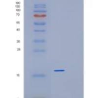 人LGALS7重组蛋白