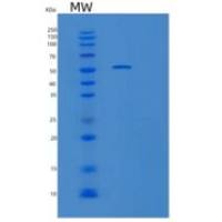 人富含亮氨酸重复跨膜蛋白/FLRT2重组蛋白