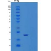 人LGALS14重组蛋白