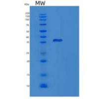 人乳酸脱氢酶B(LDHB)重组蛋白