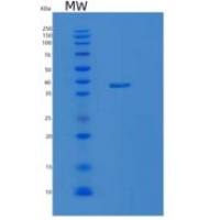 小鼠乳酸脱氢酶A(LDHA)重组蛋白
