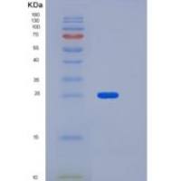 小鼠低密度脂蛋白受体(LDLR)重组蛋白
