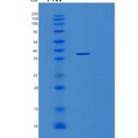 人丝裂原激活蛋白激酶激酶3(MAP2K3)重组蛋白