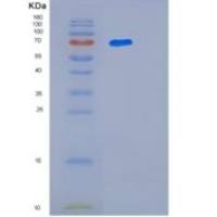 人白三烯A4水解酶(LTA4H)重组蛋白