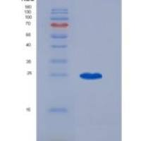 人T-细胞激活连接蛋白(LAT)重组蛋白