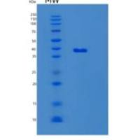 小鼠LGALS8重组蛋白