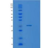 小鼠溶血磷脂酶Ⅰ(LYPLA1)重组蛋白