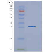 人白血病抑制因子(LIF)重组蛋白