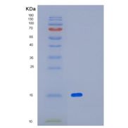 人白细胞表面抗原CD47重组蛋白