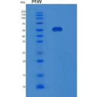 人单氨氧化酶A(MAOA)重组蛋白